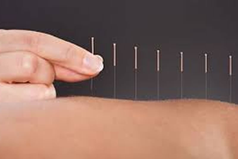 雷法针炙不让病气反噬 雷法针炙不让病气反噬